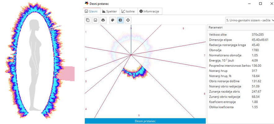 Biopolje desnega prstanca