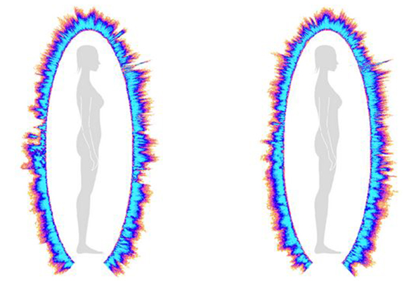 Pred in po bioenergoterapiji